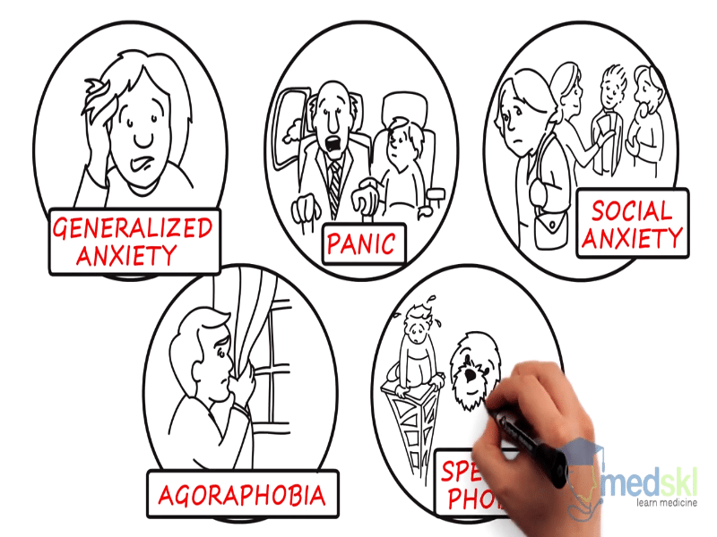 some different forms of anxiety disorders